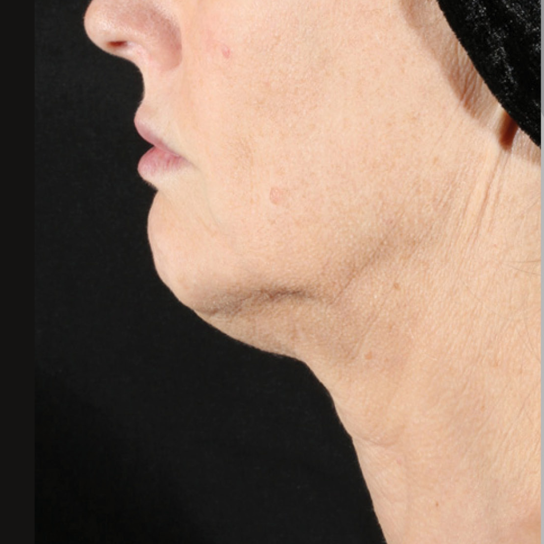 Untitled design (32)